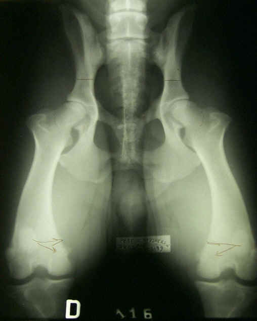 Displasia dell'anca - Errori di posizionamento 5