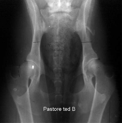 Displasia dell'anca - Classificazione grado quasi normale