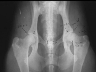 Displasia dell'anca - Classificazione grado leggera