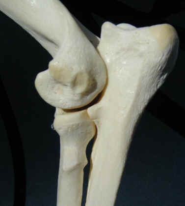 Displasia del gomito - Anatomia 1